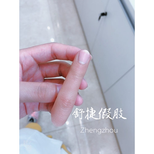 安裝假手指的接口如何處理比較好？