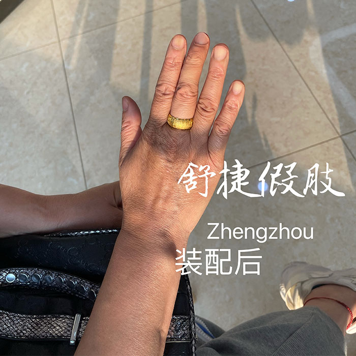 美容假手，假手指.jpg