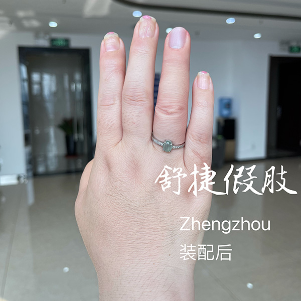 美容假手指裝配后效果，根本看不出來.jpg